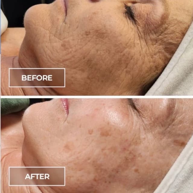 SWiCH Series of 6 at Salt + Light Skincare in Atascocita, TX